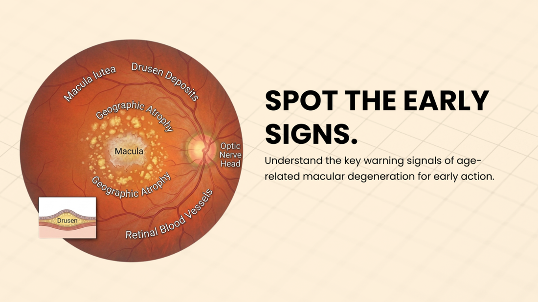 What Are the Warning Signs of Age-Related Macular Degeneration (AMD)?