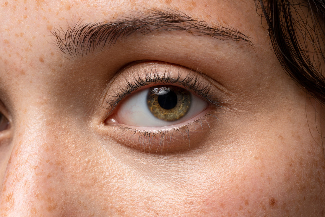 Top 10 Signs Your Eyes Need More Antioxidants